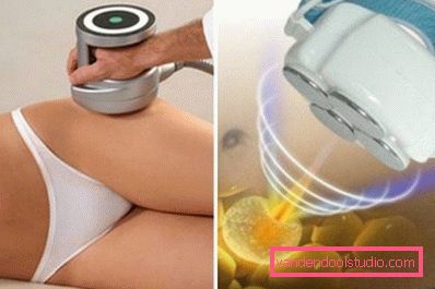 kavitacija za mršavljenje kavitacija za mršavljenje