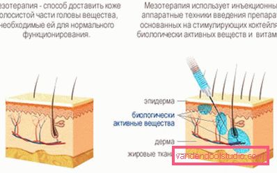 Mezoterapija kose