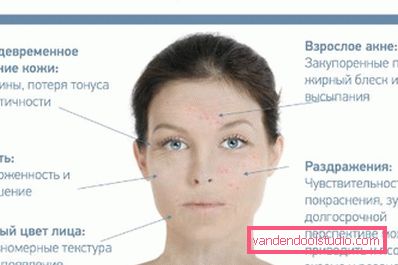 simptomi stresa na koži