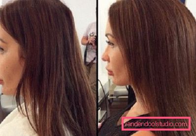 Radikalni volumen kose Boost Up (Boost UP) - sve o postupku