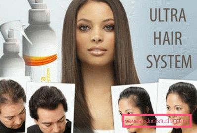 liječenje alopecije liječenje alopecije