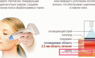 aparati s termičkom kočnicom aparati s termičkom kočnicom