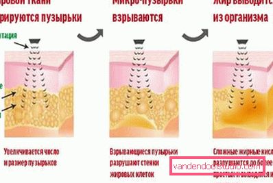 program djelovanja