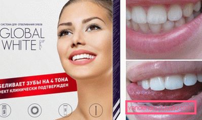 Svjetlo bijelo za blistavi osmijeh Svjetlo bijelo za blistavi osmijeh